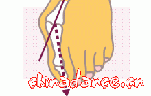 外反母趾.gif