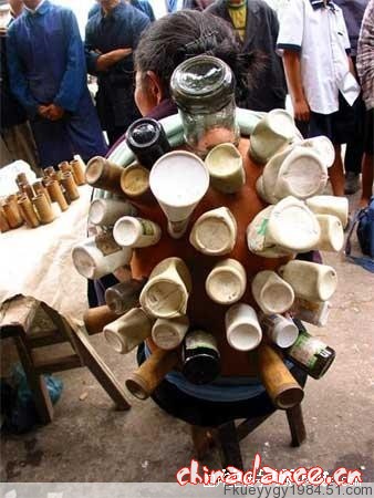 拔火罐的最高境界