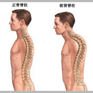 如何克服改正舞者的不良身体习惯——圆肩驼背